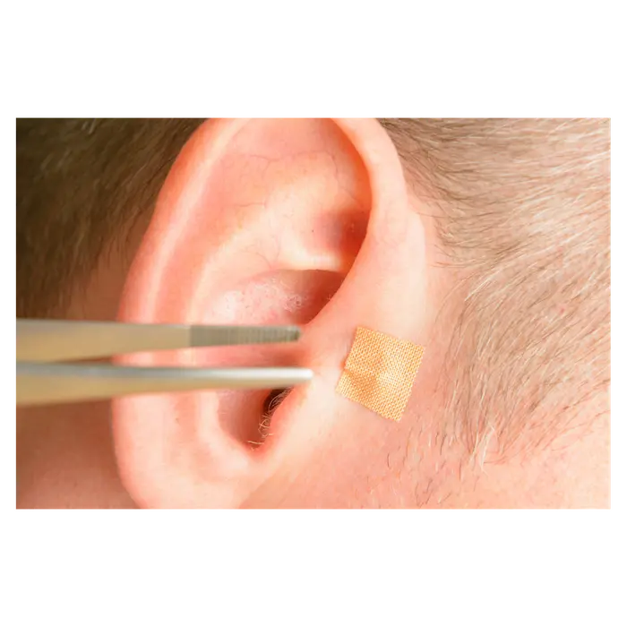 Auriculoterapia